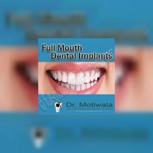 fullmouthdentalimplants